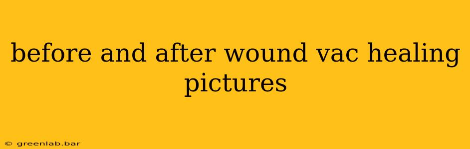 before and after wound vac healing pictures