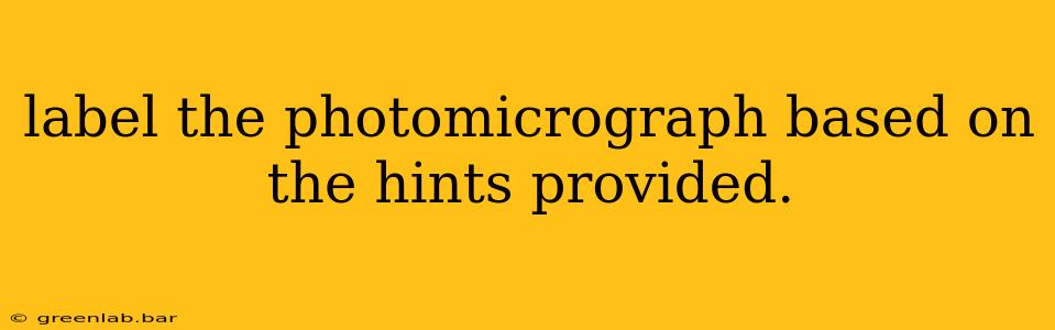 label the photomicrograph based on the hints provided.