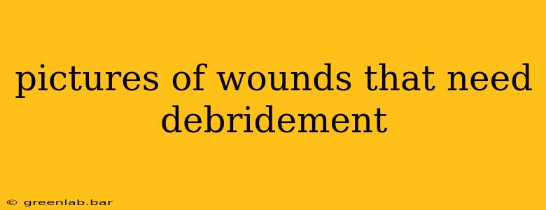 pictures of wounds that need debridement